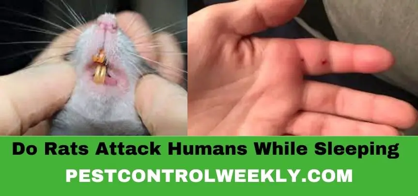 do rats attack humans while sleeping