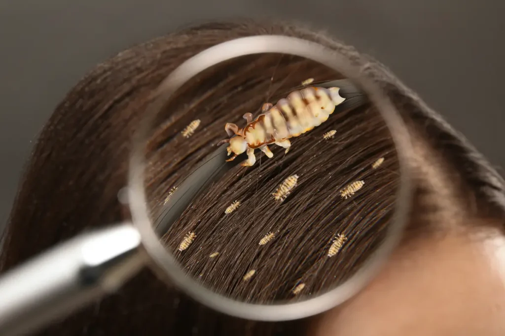 Humans Get Lice
